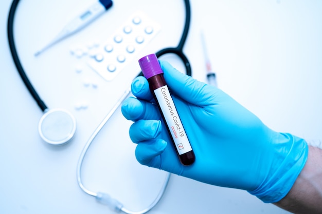 Photo docteur main dans un tube de tenue de gants médicaux avec un résultat de test sanguin positif pour la propagation rapide du coronavirus covid-19 en laboratoire. concept de médecine et d'épidémie.