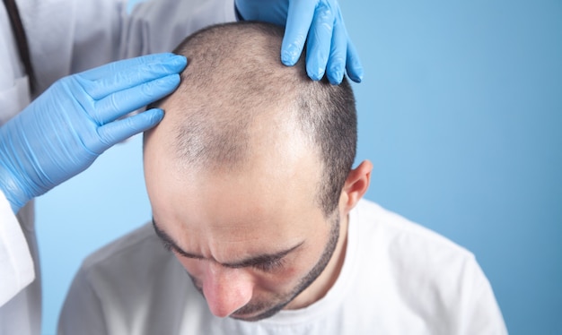 Docteur mains sur la tête du patient. La pousse des cheveux