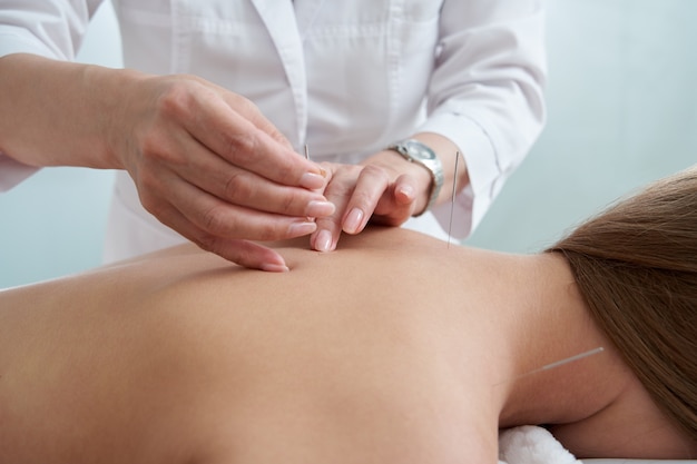 Photo le docteur met des aiguilles dans le dos femelle sur la thérapie de traitement d'acuponcture dans l'alternative de salon de station thermale