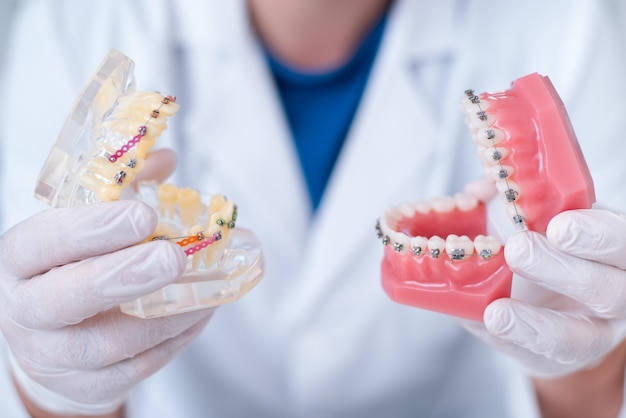 Docteur orthodontiste montre comment le système d'accolades sur les dents est organisé