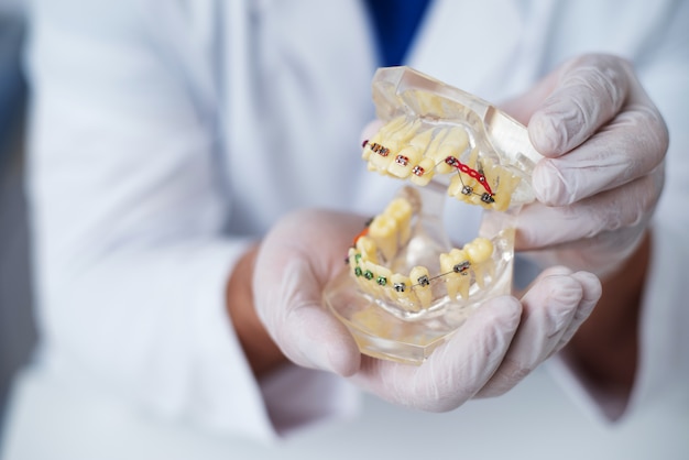 Docteur orthodontiste montre comment le système d'accolades sur les dents est organisé