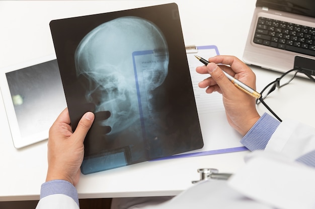 Docteur regardant le film radiographique de la tête au bureau.