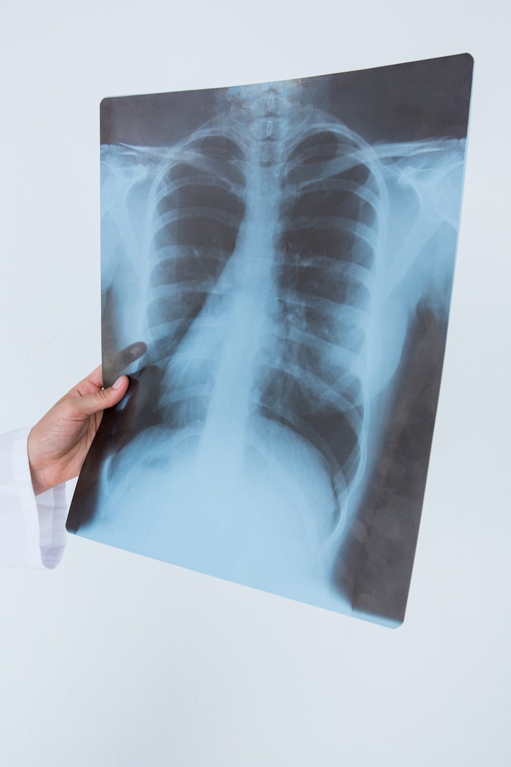 Photo docteur tenant aux rayons x