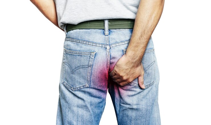 Douleur hémorroïdaire, homme souffrant d'hémorroïdes sur blanc avec un tracé de détourage. Homme avec digestif