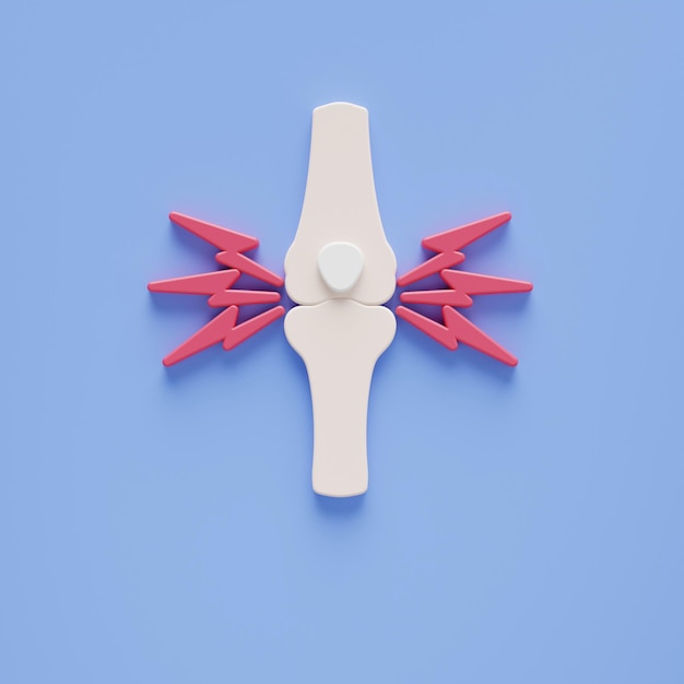 Douleurs articulaires au genou. Blessure osseuse illustration de rendu 3d.