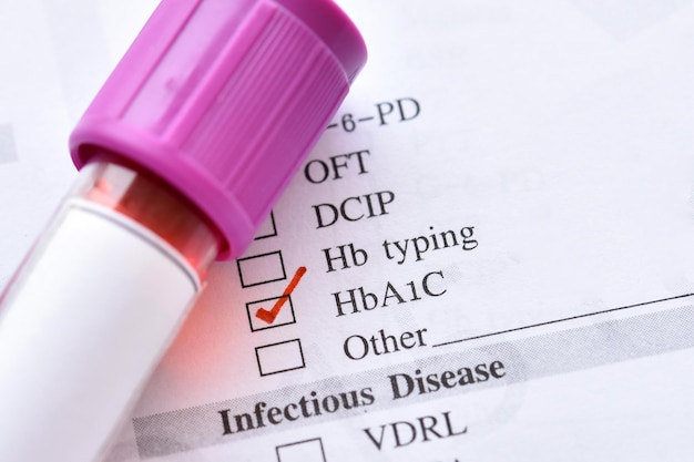 Photo Échantillon de sang pour le diagnostic du diabète par test hba1c