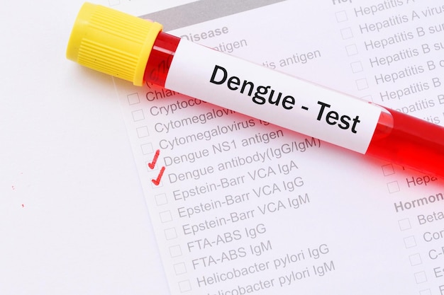 Photo Échantillon de sang pour le test du virus de la dengue