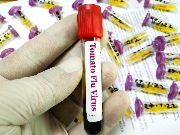 Photo Échantillon de sang pour le test de la grippe tomate ou de la fièvre de la tomate. elle se caractérise par de la fièvre, des douleurs articulaires, une éruption cutanée rouge