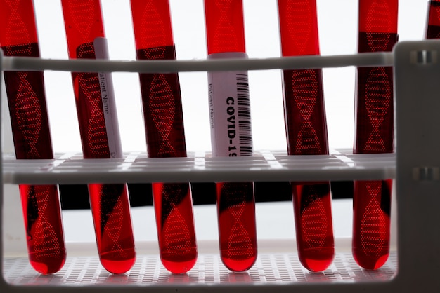 Photo Échantillon de test sanguin avec icône adn pour le virus covid 19