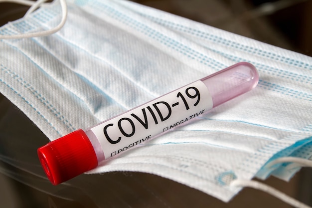 Des échantillons de tubes à essai de sang vides pour la présence de coronavirus se trouvent sur les masques médicaux.