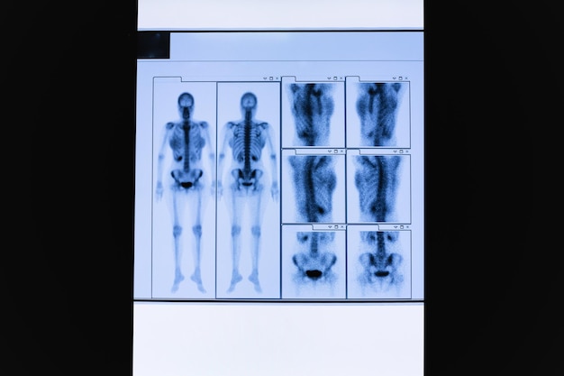 Photo ensemble d'analyses tc du squelette du corps entier féminin et des organes internes
