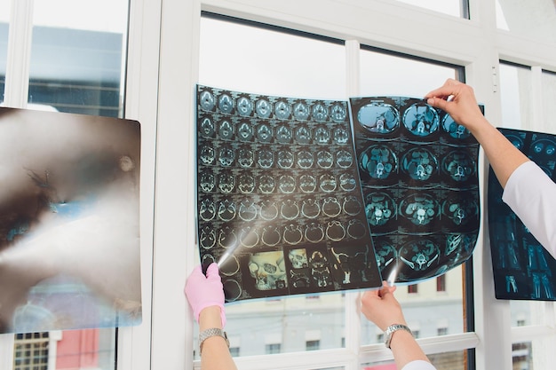 Photo une équipe médicale professionnelle examine les dossiers médicaux des patients et les radiographies cérébrales.