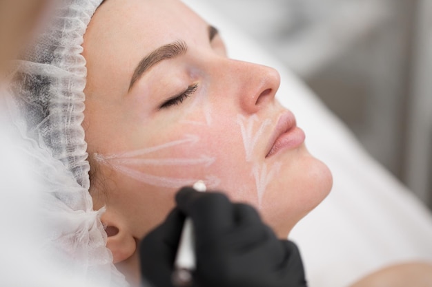 L'esthéticienne dessine les contours d'un crayon blanc sur le visage du patient