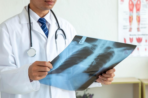 Examen aux rayons X Radiologie du squelette