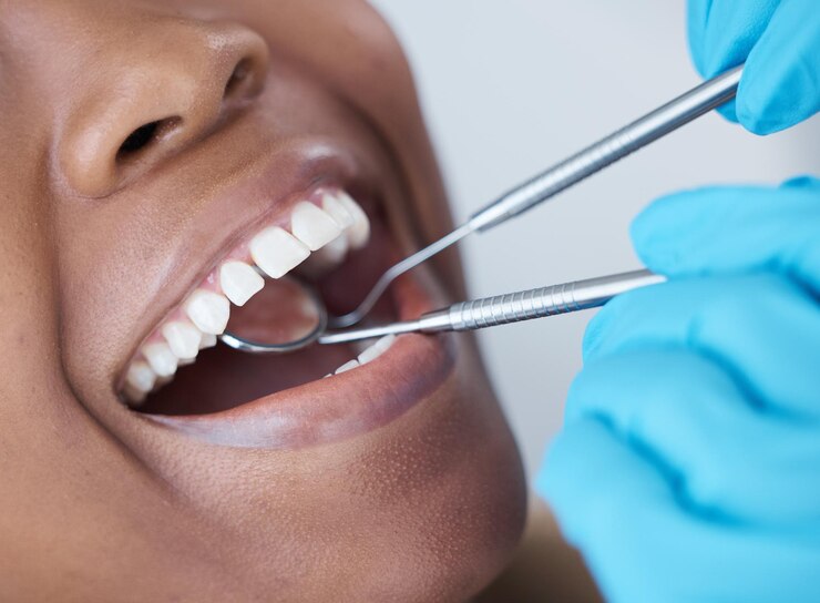 Photo examen de la bouche et de la femme chez le dentiste pour les soins dentaires et la recherche de caries miroir en bonne santé et médecin regardant les dents d'un patient pour un traitement d'hygiène buccale et de chirurgie