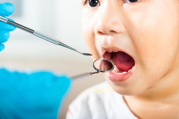 Photo examen de santé dentaire pour enfants dentiste asiatique effectuant une procédure d'examen pour une jolie petite fille à bouche ouverte le médecin examine la cavité buccale du petit enfant utilise un miroir buccal pour vérifier la cavité dentaire