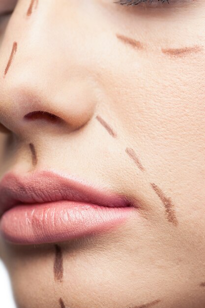 Extreme close up sur le patient mignon avec des lignes pointillées sur le visage