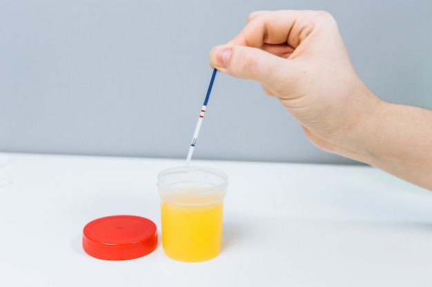 Faire un test de grossesse avec une banque d'urine