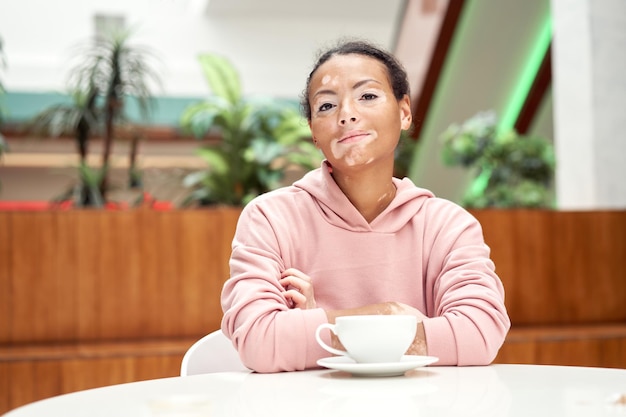 Femme afro-américaine noire avec problème de peau de pigmentation vitiligo intérieur vêtu d'un sweat à capuche rose