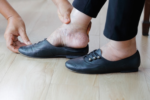 Femme âgée pieds enflés mettant des chaussures avec un soignant.