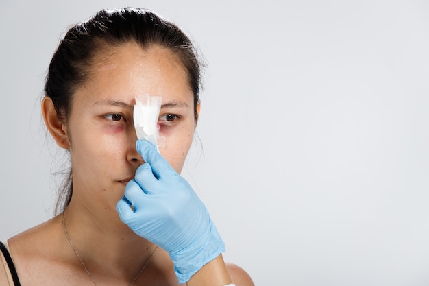 Une femme asiatique a pratiqué la chirurgie plastique du nez pour se redresser. Contrôle médical après la rhinoplastie, le patient a besoin d'un bandage sur le nez pendant deux semaines.