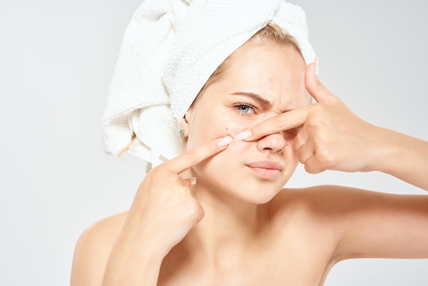 Femme aux épaules nues avec une serviette sur la tête dermatologie de l'acné