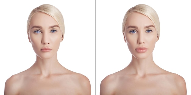 Femme avant après chirurgie plastique nez et lèvres. Correction esthétique des lèvres, chirurgie plastique, chirurgie de réduction du nez, réduction du nez. Médecine esthétique. Portrait jeune femme après chirurgie plastique