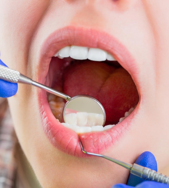 Femme chez le dentiste Soins dentaires en prenant soin des dents Fille ayant des dents examinées chez les dentistes Femme dans une clinique de stomatologie avec un dentiste Concept de dents saines