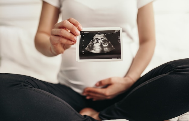 Femme enceinte avec image sonogramme