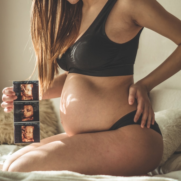 Femme enceinte tenant l'image de l'échographie. Concept de grossesse, soins de santé, gynécologie, médecine. Jeune mère attendant le bébé