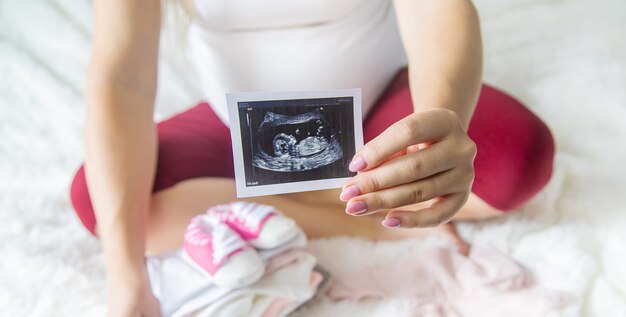 Une femme enceinte tient un instantané d'une échographie dans ses mains. Mise au point sélective.