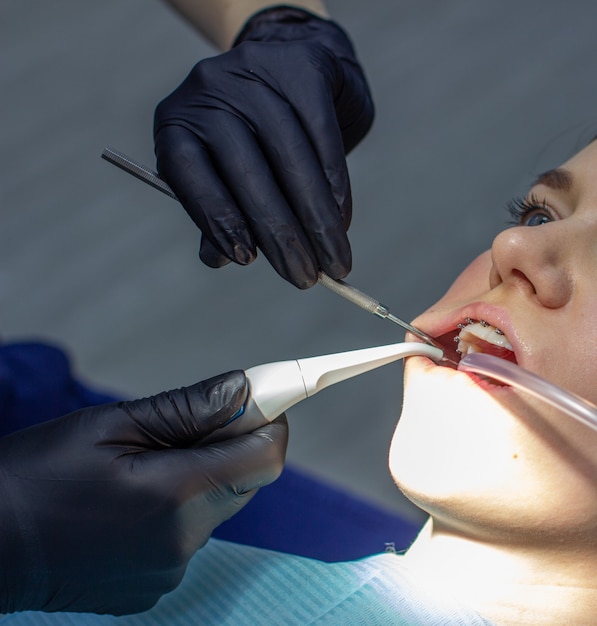 Une femme est équipée d'appareils dentaires sur ses dents dans un fauteuil dentaire une visite chez un orthodontiste