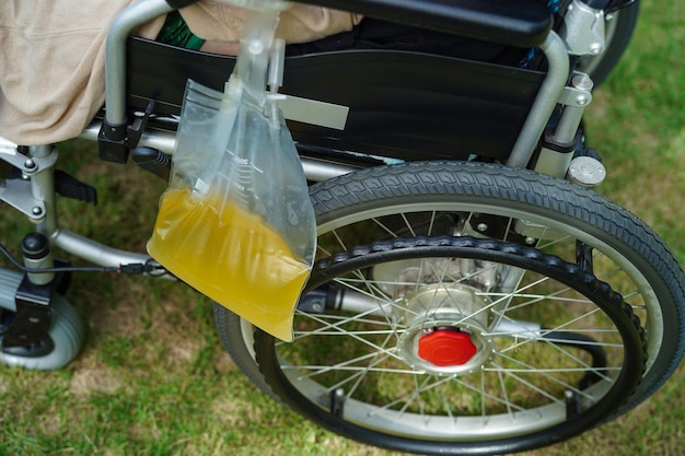 Femme handicapée asiatique avec sac d'urine sur fauteuil roulant