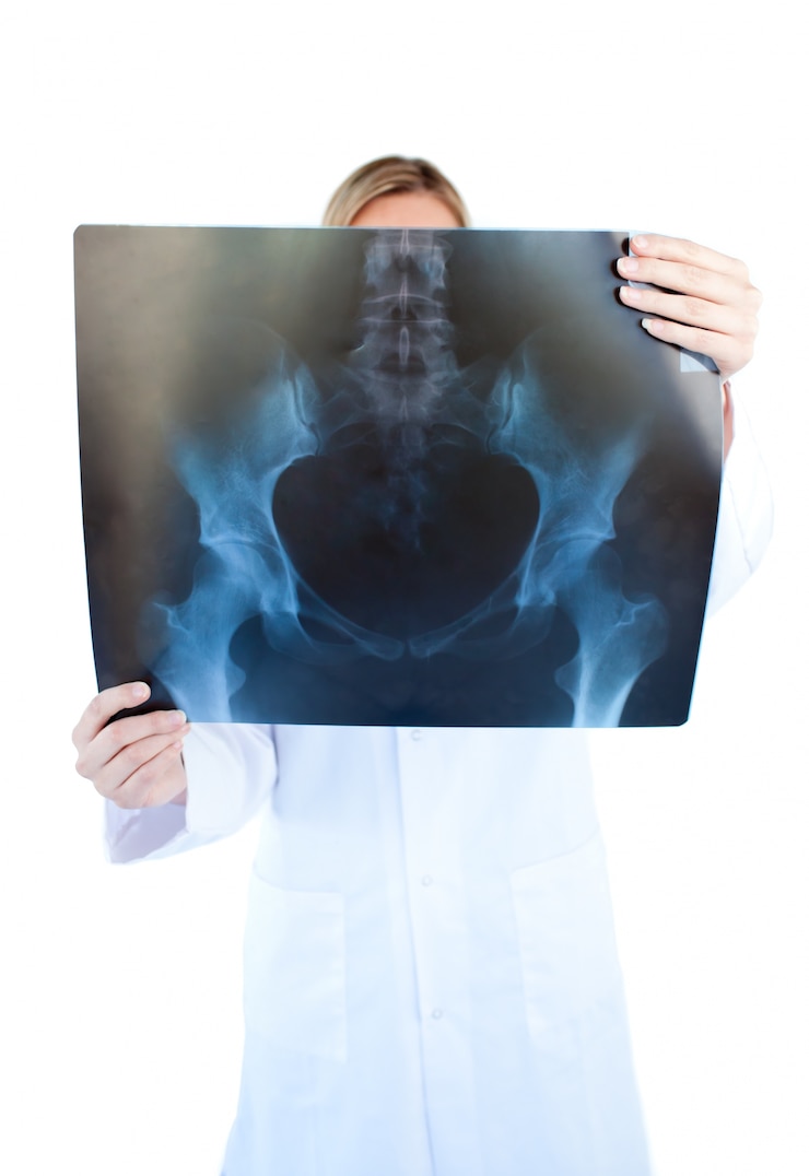 Photo femme médecin concentrée tenant une radiographie