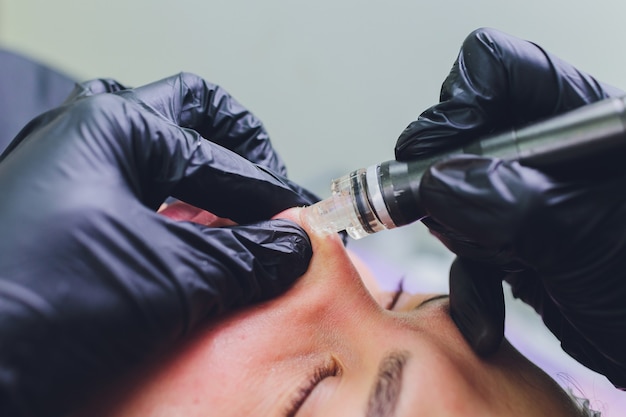 Femme nettoyant les pores de la peau du nez à l'aide d'un dissolvant de points noirs sous vide, procédure cosmétique.