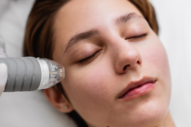 La femme reçoit un traitement facial avec une machine sur le nez, les joues, la peau, les lèvres, les cils et