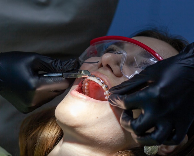 Une femme à un rendez-vous chez le dentiste pour remplacer les arches par des accolades