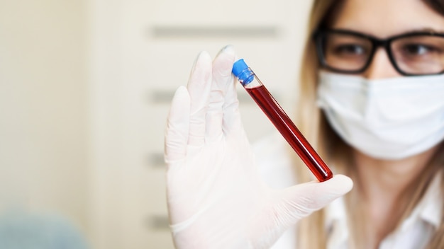 femme scientifique tenant un tube à essai avec un échantillon de sang. diagnostic de virus et de maladies