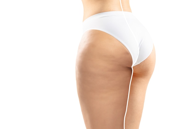 Femme en surpoids avec des jambes et du ventre graisseux de cellulite, corps féminin d'obésité comparé à un corps en forme