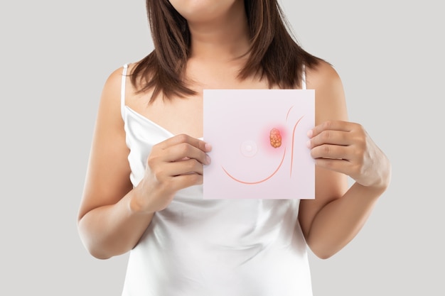 Une femme tenant un papier rose clair avec l'image des cellules cancéreuses du sein.