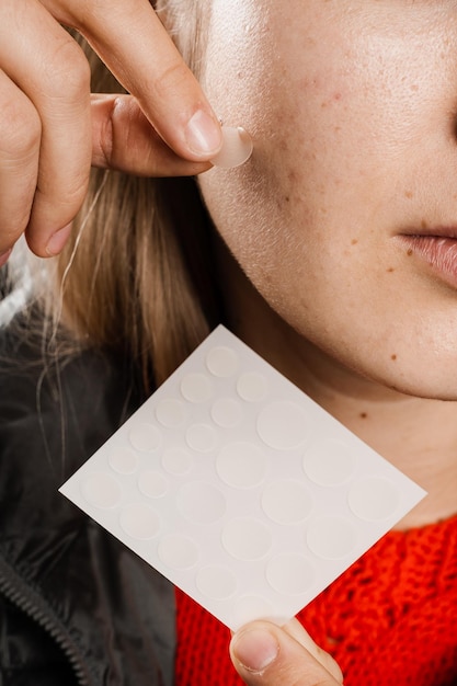 Femme utilisant des patchs d'acné pour le traitement des boutons et de la rosacée en gros plan Rajeunissement du visage nettoyant la cosmétologie Fille avec un bâton d'acné autour d'un patch d'acné sur sa joue