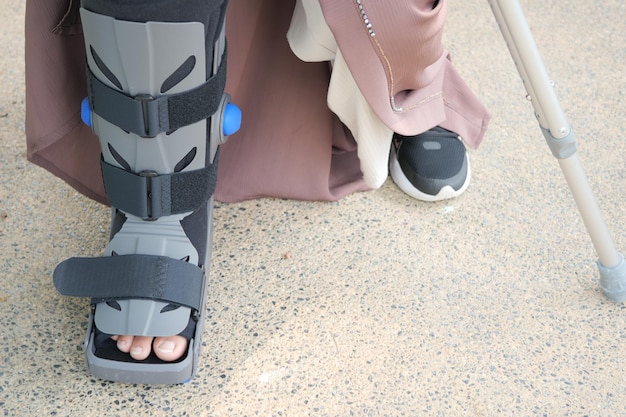Femmes pieds cassés avec une botte en plastique gris chevillère blessure protégeant la botte