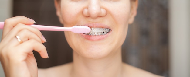 Fille avec des accolades sur ses dents se brosser les dents avec une brosse à dents, gros plan. Soins dentaires et bucco-dentaires. Accolades pour niveler les dents