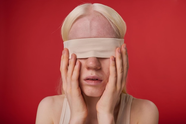 Fille albinos avec un bandage sur les yeux