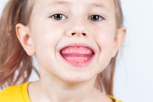 Une fille de race blanche de six ans montre un entraîneur myofonctionnel dans sa bouche