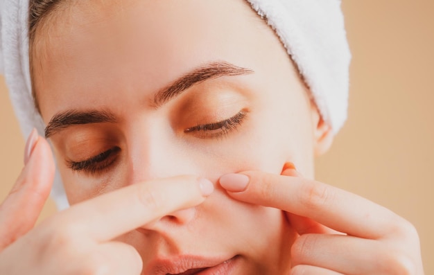 Fille serrant des boutons sur le visage taches d'acné taches de peau sur la jeune femme cicatrice taches de rousseur d'acné et moi