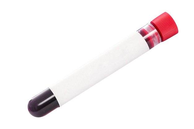 Flacon de test sanguin d'échantillon