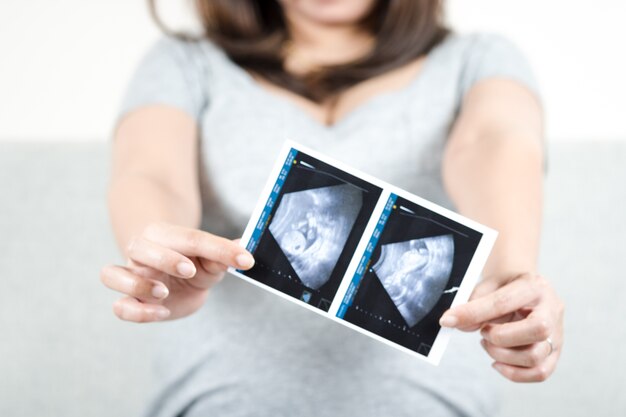 Floue de femme enceinte heureuse assis sur le canapé à la maison tenant des photos d&#39;échographie