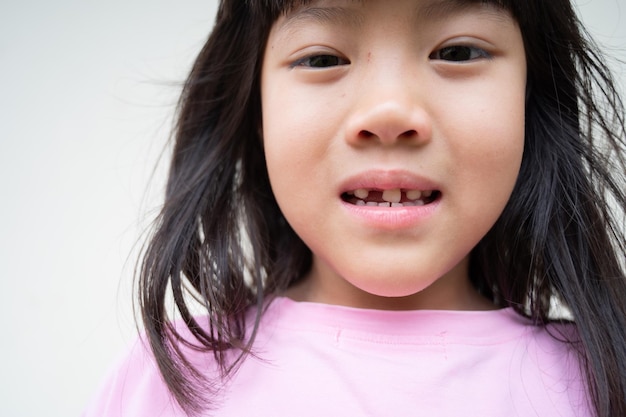 gosse, dent cassée, fille asiatique, sourire