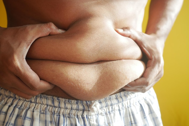 Photo gros homme avec un gros ventre sur fond jaune